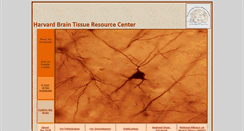 Desktop Screenshot of brainbank.mclean.org