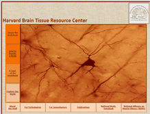 Tablet Screenshot of brainbank.mclean.org